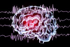 EEG Scan