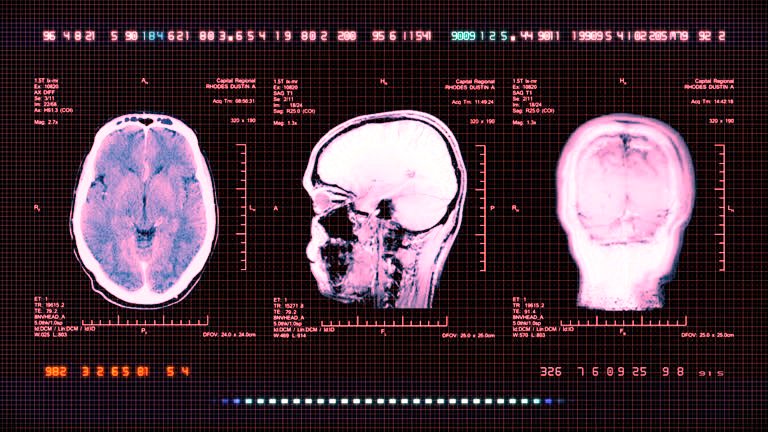 CT Scan